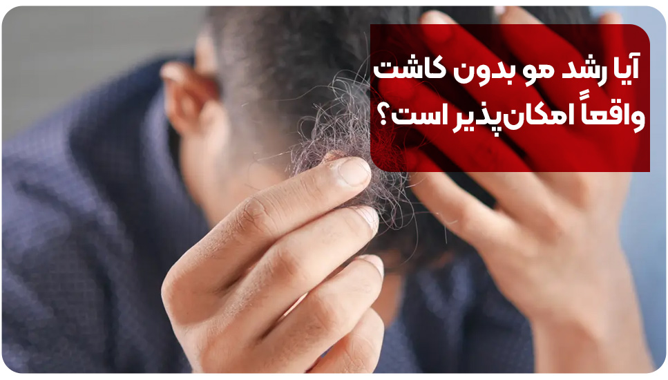 آیا رشد مو مجدد بدون کاشت واقعاً امکان‌پذیر است؟