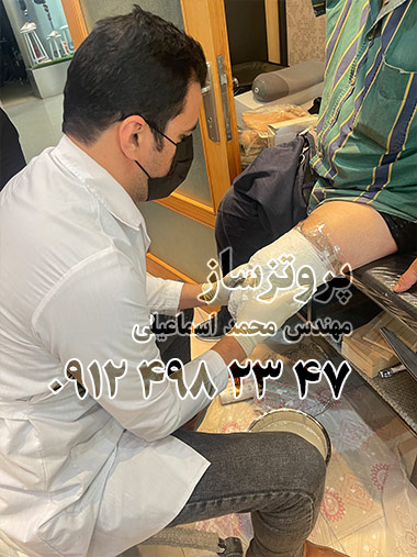 بهترین پروتز پا